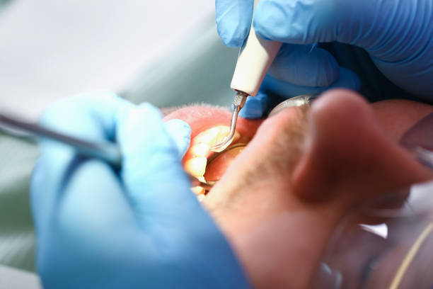 Best Emergency Dentist for Knocked-Out Tooth in Waterman, IL
