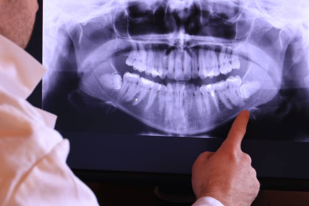 Best Emergency Dental Extractions in Waterman, IL