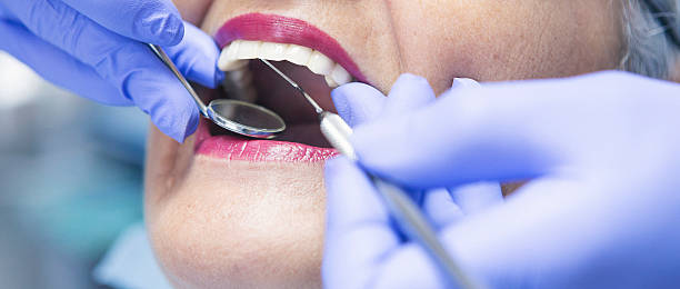 Best Emergency Dentist for Lost Fillings or Crowns in Waterman, IL